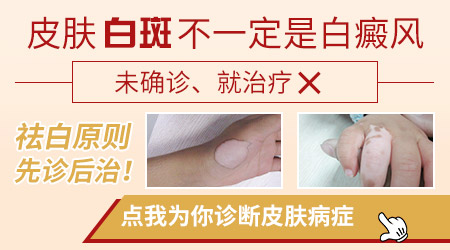 50岁了皮肤有白斑点